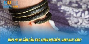 Nằm Mơ Bị Rắn Cắn Vào Chân Dự Điềm Lành Hay Xấu?